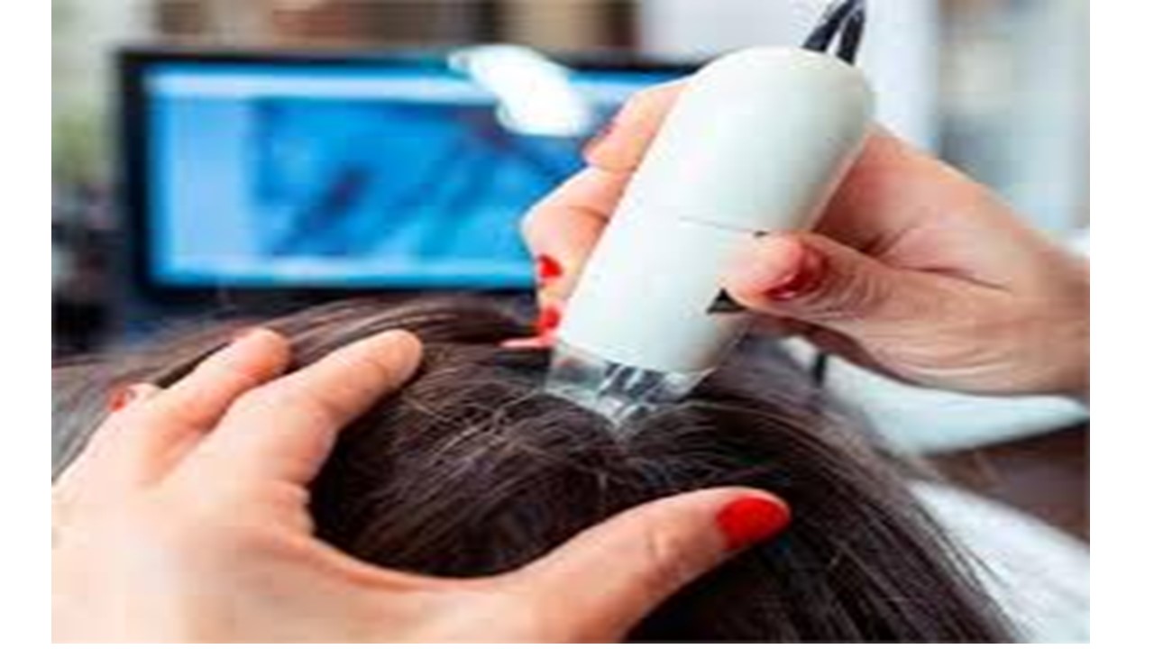 TRATAMIENTOS CAPILARES PARA CAIDA DE CABELLO CON USO DE APARATOLOGÍA